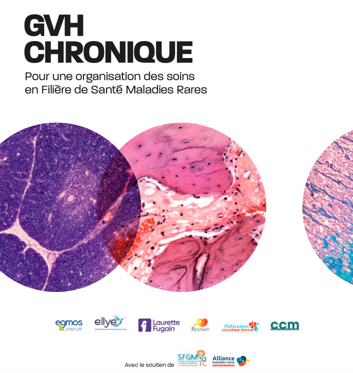 MANIFESTE GVH CHRONIQUE 